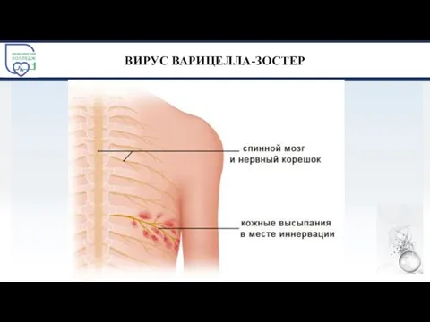 ВИРУС ВАРИЦЕЛЛА-ЗОСТЕР