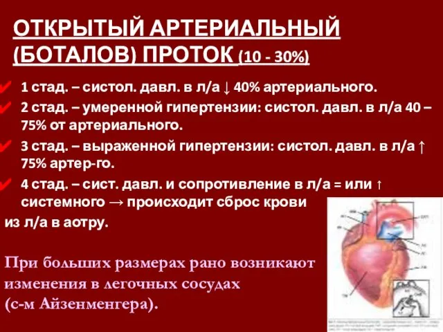 ОТКРЫТЫЙ АРТЕРИАЛЬНЫЙ (БОТАЛОВ) ПРОТОК (10 - 30%) 1 стад. – систол. давл.