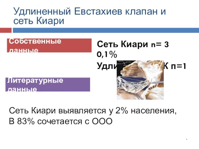 Собственные данные Литературные данные Сеть Киари n= 3 0,1% Удлиненный ЕК п=1