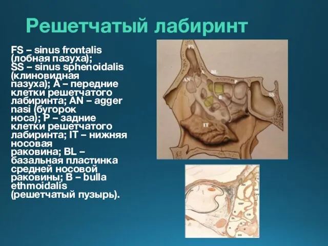 Решетчатый лабиринт FS – sinus frontalis (лобная пазуха); SS – sinus sphenoidalis