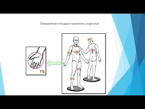 Определение площади поражения у взрослых