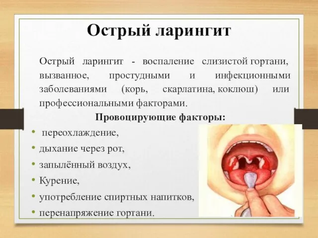 Острый ларингит Острый ларингит - воспаление слизистой гортани, вызванное, простудными и инфекционными