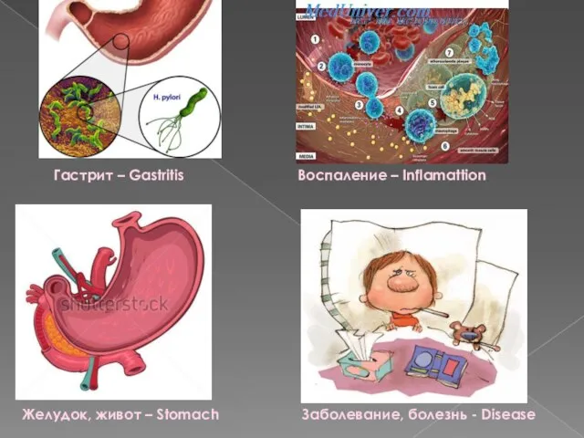 Гастрит – Gastritis Воспаление – Inflamattion Желудок, живот – Stomach Заболевание, болезнь - Disease