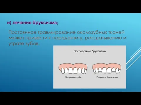 и) лечение бруксизма; Постоянное травмирование околозубных тканей может привести к пародонтиту, расшатыванию и утрате зубов.