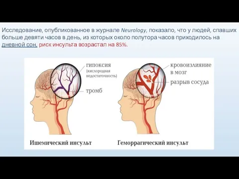 Исследование, опубликованное в журнале Neurology, показало, что у людей, спавших больше девяти