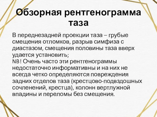 Обзорная рентгенограмма таза В переднезадней проекции таза – грубые смещения отломков, разрыв