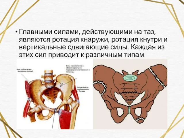 Главными силами, действующими на таз, являются ротация кнаружи, ротация кнутри и вертикальные