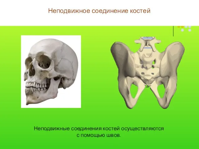 Неподвижное соединение костей Неподвижные соединения костей осуществляются с помощью швов.