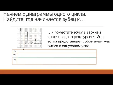 Начнем с диаграммы одного цикла. Найдите, где начинается зубец P… П АВС