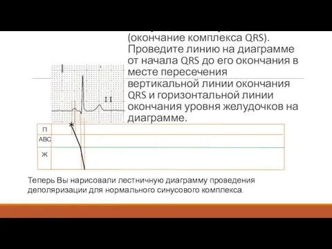 Теперь найдите окончание возбуждения желудочков (окончание комплекса QRS). Проведите линию на диаграмме