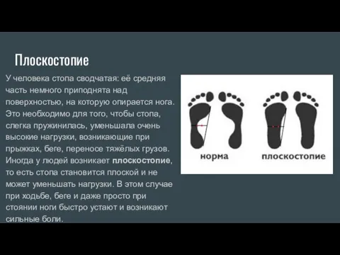 Плоскостопие У человека стопа сводчатая: её средняя часть немного приподнята над поверхностью,