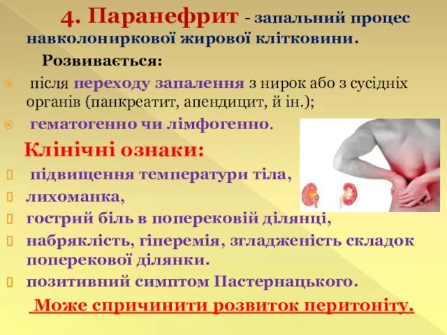 4. Паранефрит - запальний процес навколониркової жирової клітковини. Розвивається: після переходу запалення