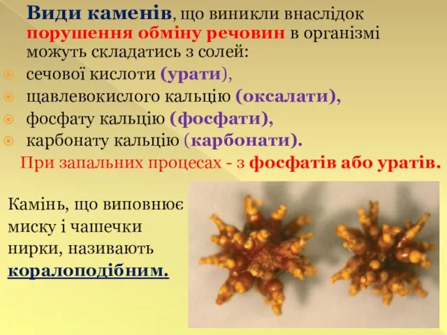 Види каменів, що виникли внаслідок порушення обміну речовин в організмі можуть складатись