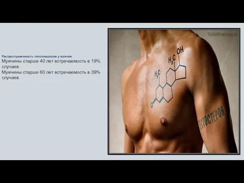 Распространенность гипогонадизма у мужчин Мужчины старше 40 лет встречаемость в 19% случаев