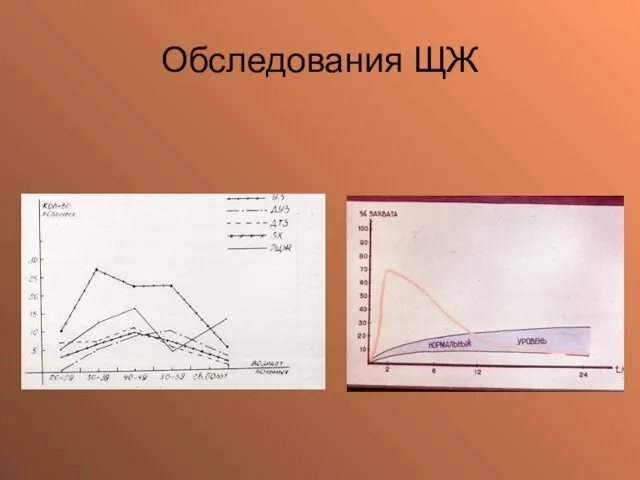 Обследования ЩЖ