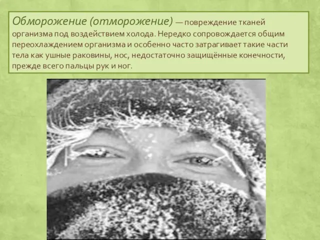 Обморожение (отморожение) — повреждение тканей организма под воздействием холода. Нередко сопровождается общим