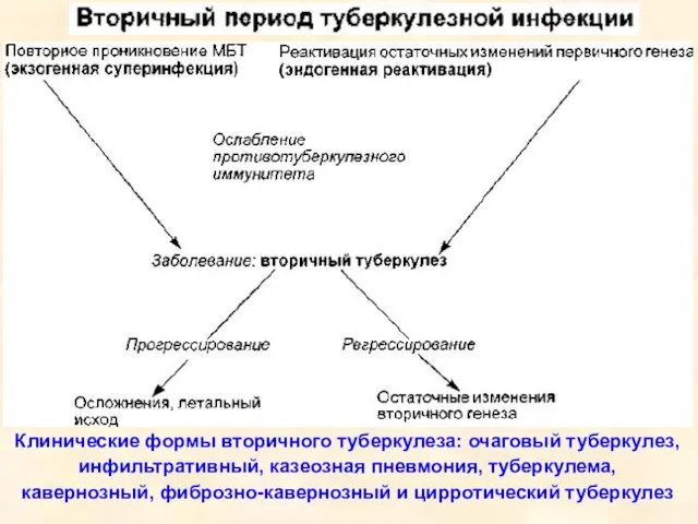 Клинические формы вторичного туберкулеза: очаговый туберкулез, инфильтративный, казеозная пневмония, туберкулема, кавернозный, фиброзно-кавернозный и цирротический туберкулез