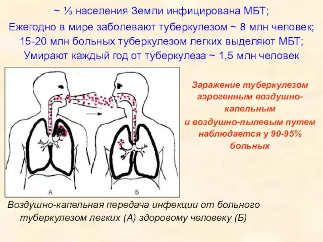 ~ ⅓ населения Земли инфицирована МБТ; Ежегодно в мире заболевают туберкулезом ~