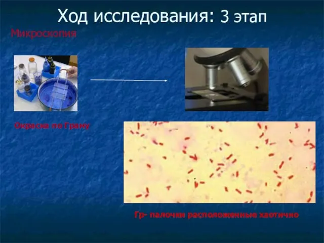 Ход исследования: 3 этап Микроскопия Окраска по Граму Гр- палочки расположенные хаотично