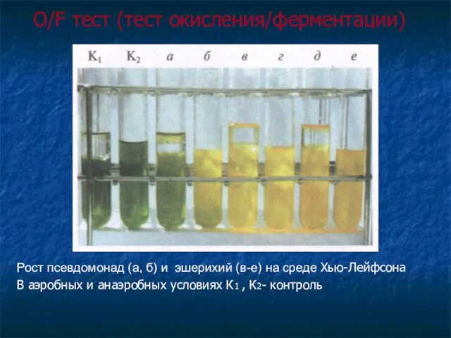 Рост псевдомонад (а, б) и эшерихий (в-е) на среде Хью-Лейфсона В аэробных