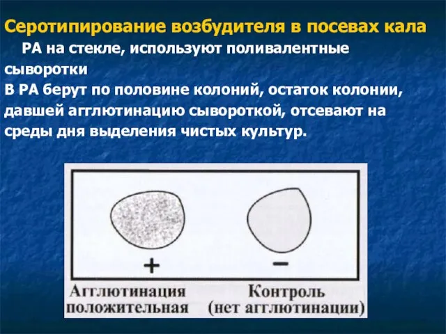 Серотипирование возбудителя в посевах кала РА на стекле, используют поливалентные сыворотки В