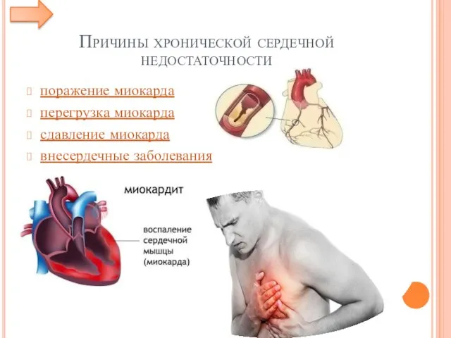 Причины хронической сердечной недостаточности поражение миокарда перегрузка миокарда сдавление миокарда внесердечные заболевания