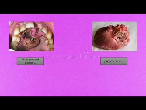 Миаз ротовой полости Дирофиляриоз