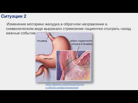 Ситуация 2 Изменение моторики желудка в обратном направлении в символическом виде выражало