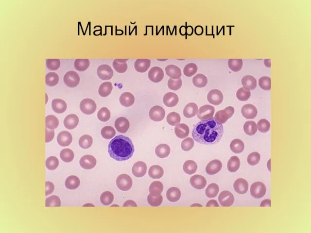 Малый лимфоцит