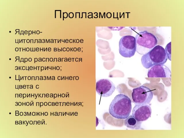 Проплазмоцит Ядерно-цитоплазматическое отношение высокое; Ядро располагается эксцентрично; Цитоплазма синего цвета с перинуклеарной