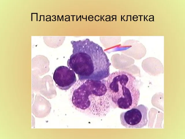 Плазматическая клетка