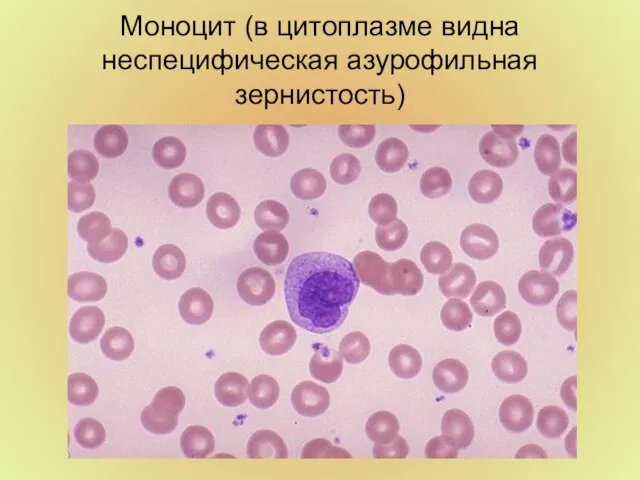 Моноцит (в цитоплазме видна неспецифическая азурофильная зернистость)