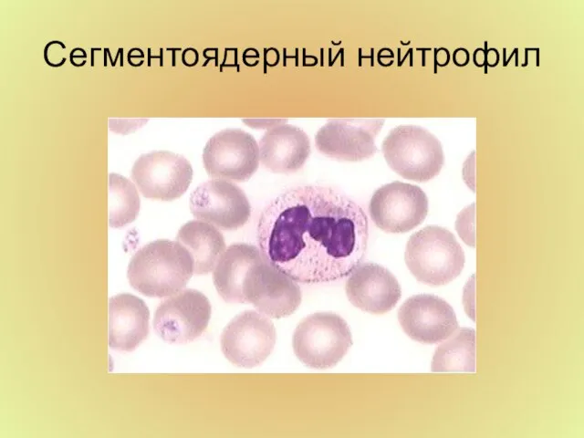 Сегментоядерный нейтрофил