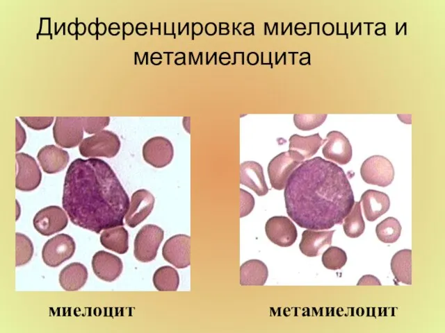 Дифференцировка миелоцита и метамиелоцита миелоцит метамиелоцит