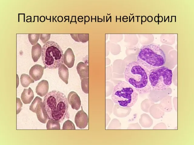 Палочкоядерный нейтрофил