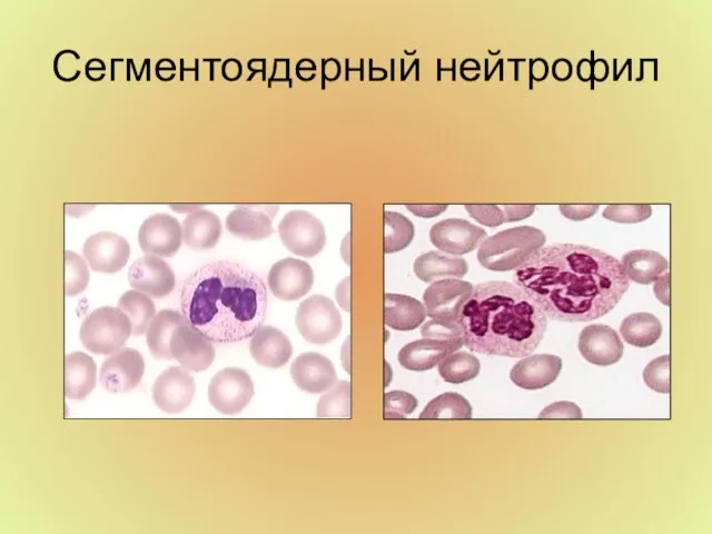 Сегментоядерный нейтрофил