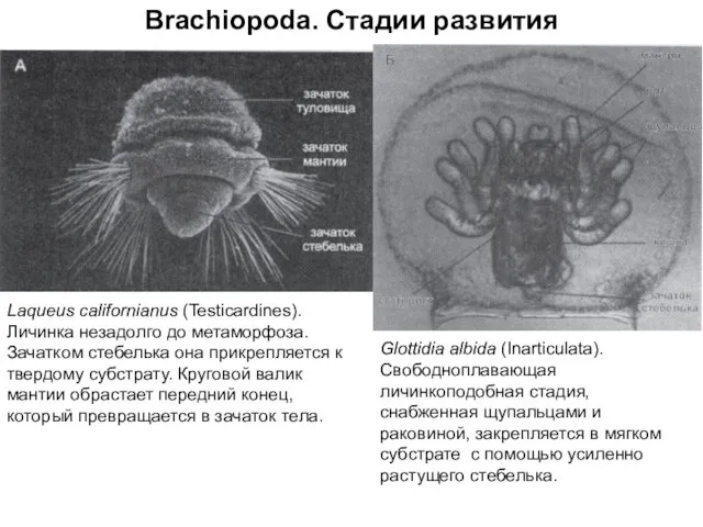 Brachiopoda. Стадии развития Laqueus californianus (Testicardines). Личинка незадолго до метаморфоза. Зачатком стебелька