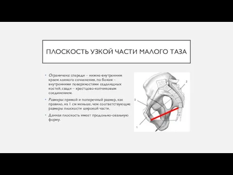 ПЛОСКОСТЬ УЗКОЙ ЧАСТИ МАЛОГО ТАЗА Ограничена: спереди – нижне-внутренним краем лонного сочленения,