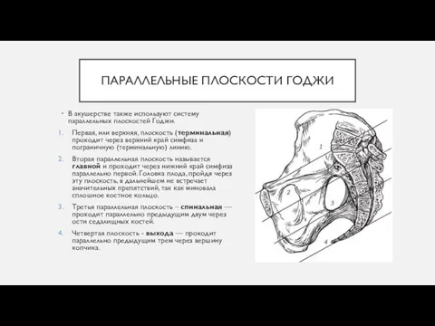 ПАРАЛЛЕЛЬНЫЕ ПЛОСКОСТИ ГОДЖИ В акушерстве также используют систему параллельных плоскостей Годжи. Первая,