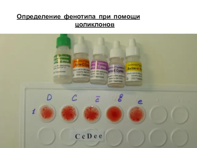 Определение фенотипа при помощи цоликлонов