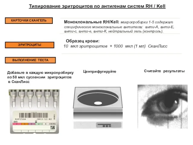 Типирование эритроцитов по антигенам систем RH / Kell КАРТОЧКИ СКАНГЕЛЬ Моноклональные RH/Kell: