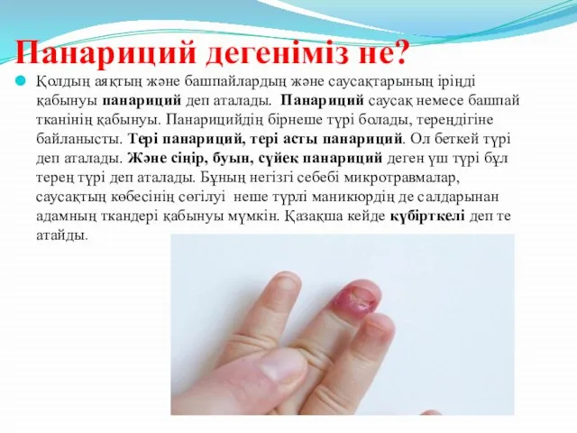 Панариций дегеніміз не? Қолдың аяқтың және башпайлардың және саусақтарының іріңді қабынуы панариций