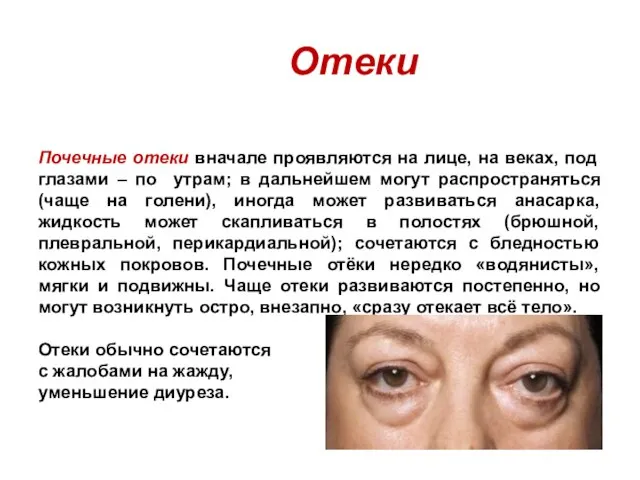 Отеки Почечные отеки вначале проявляются на лице, на веках, под глазами –