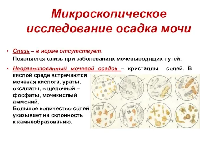 Микроскопическое исследование осадка мочи Слизь – в норме отсутствует. Появляется слизь при