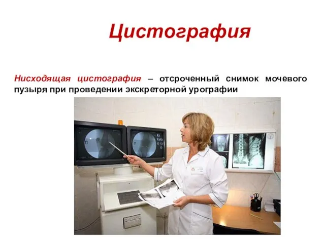 Цистография Нисходящая цистография – отсроченный снимок мочевого пузыря при проведении экскреторной урографии