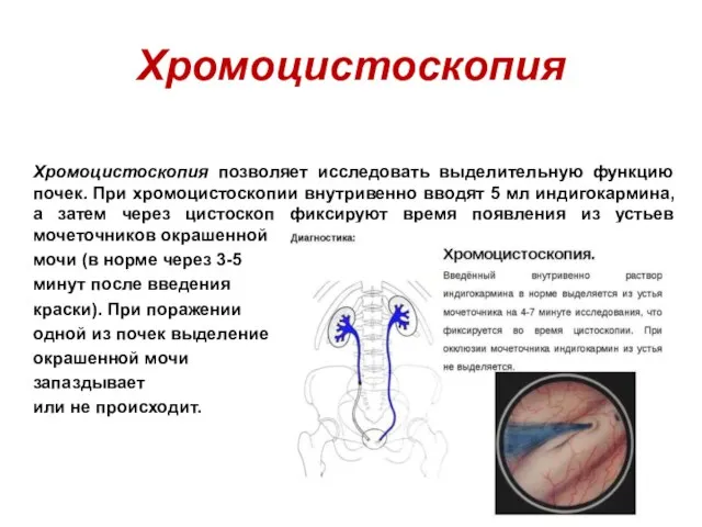 Хромоцистоскопия Хромоцистоскопия позволяет исследовать выделительную функцию почек. При хромоцистоскопии внутривенно вводят 5