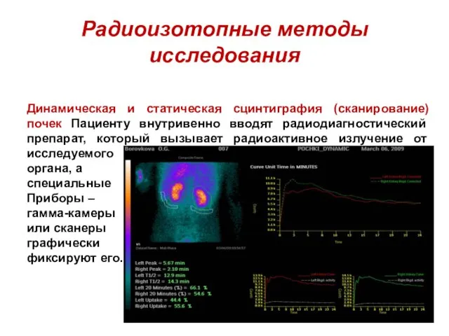 Радиоизотопные методы исследования Динамическая и статическая сцинтиграфия (сканирование) почек Пациенту внутривенно вводят