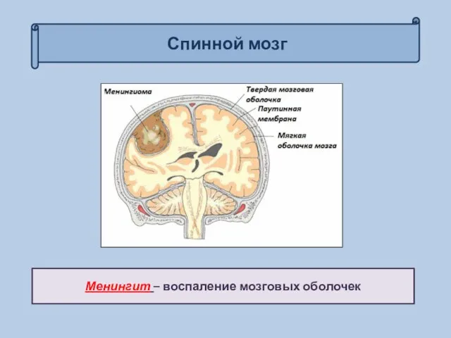 Спинной мозг Менингит – воспаление мозговых оболочек