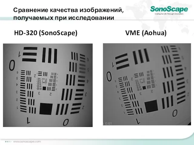 HD-320 (SonoScape) VME (Aohua) Сравнение качества изображений, получаемых при исследовании