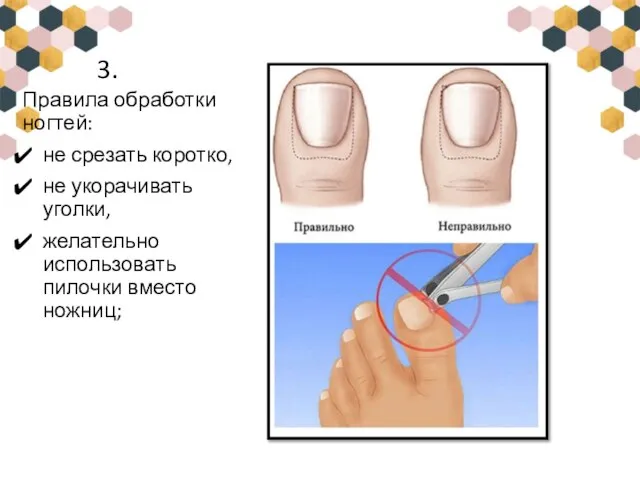 3. Правила обработки ногтей: не срезать коротко, не укорачивать уголки, желательно использовать пилочки вместо ножниц;